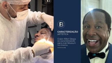 Aílton Graça fez procedimento com sangue para viver Mussum