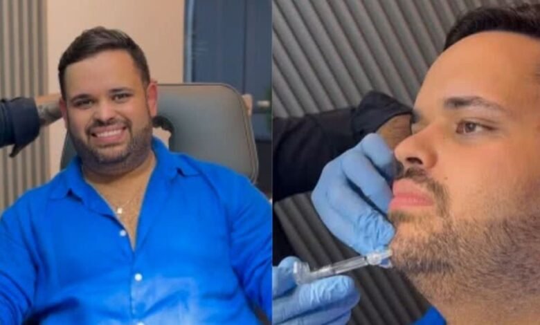 Michel, Ex-BBB 24, Revela Transformação com Platismoplastia e Preenchimento Facial